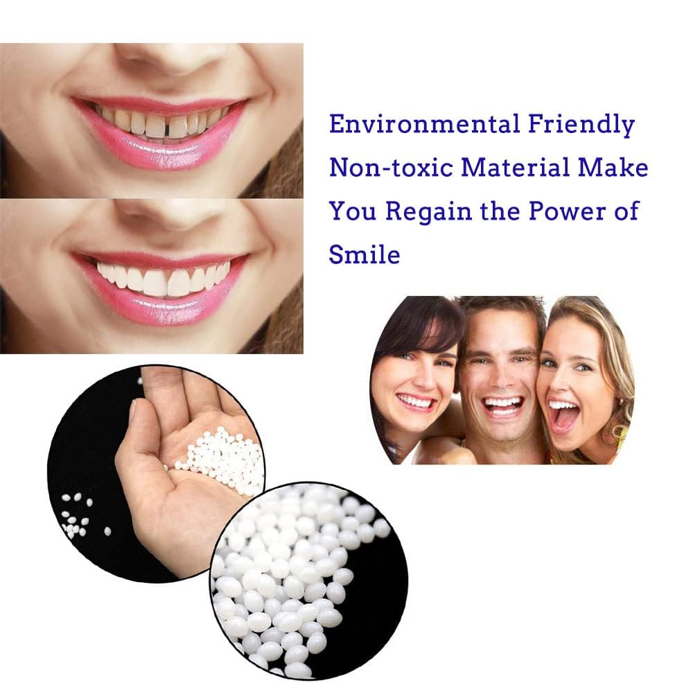 Tooth Filling Thermal Beads – DIY Moldable Temporary Teeth Repair Kit (2 Pack)