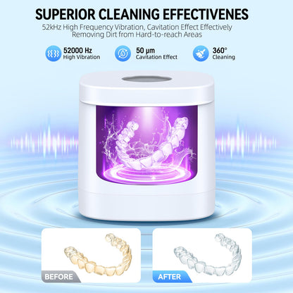 TEBAL Ultrasonic Retainer Cleaner Machine – 52kHz, 250ml, White