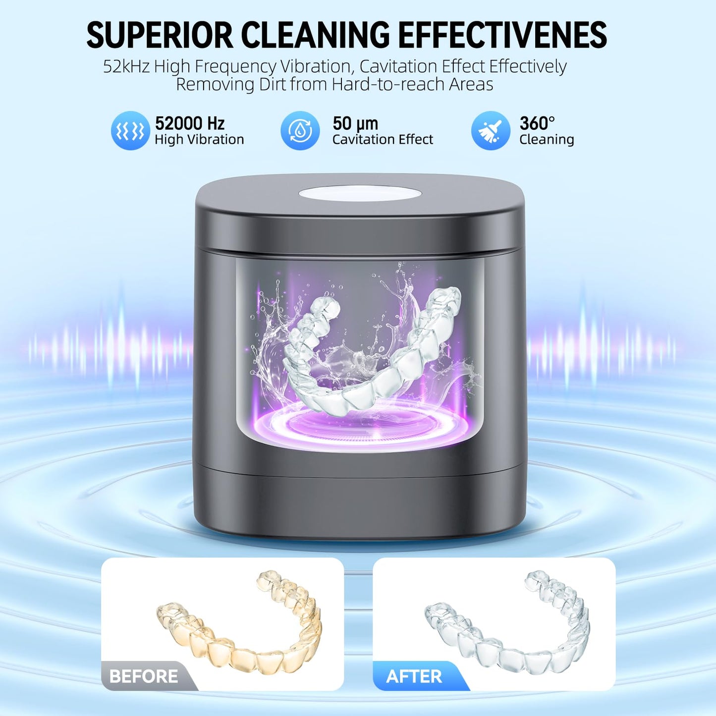 TEBAL Ultrasonic Retainer Cleaner – 52kHz, 250ml, for Retainers & More | Black