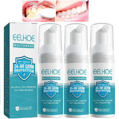 3Pcs Teeth Mouthwash Foam – Stain Removal & Fresh Breath (30ml x3)