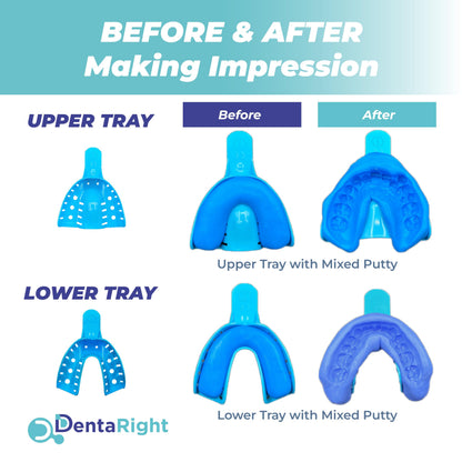 Mouth Guard for Teeth Grinding – Soft Custom-Fit Night Guard (1 Piece) – Upper or Lower