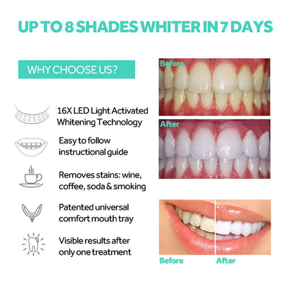 Teeth Whitening Accelerator Light – 16x Powerful Blue LED for Home Whitening