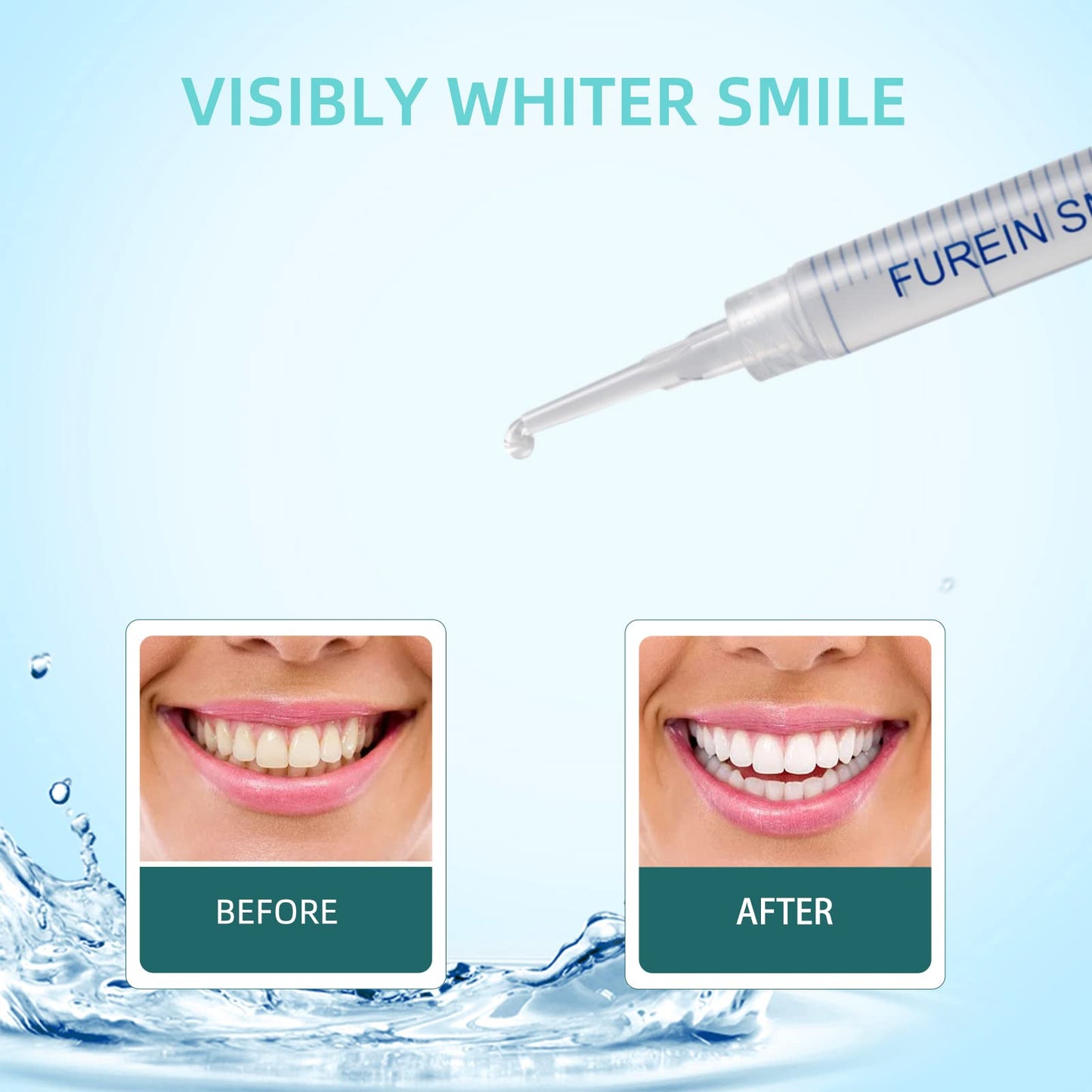 Teeth Whitening Gel Refills 10PCS – 48+ Treatments | 35% Carbamide Peroxide