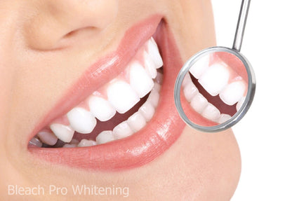 Teeth Whitening Gel Syringe 10ml - 44% Carbamide Peroxide - 4 Pack