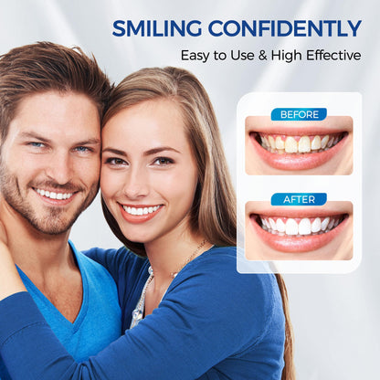 Teeth Whitening Kit for Sensitive Teeth – 4 Carbamide Pens + Remineralization Pen | LED Light