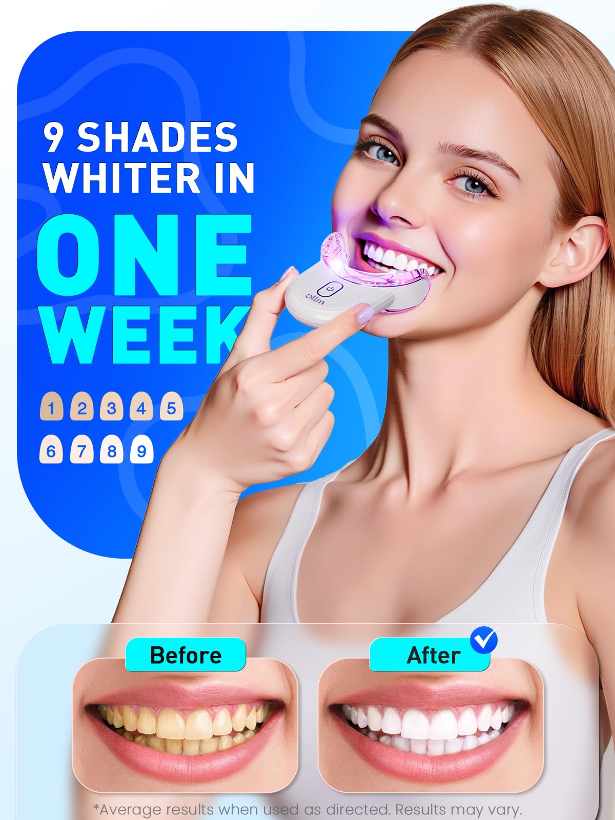 Teeth Whitening Kit for Sensitive Teeth – 35% Carbamide Peroxide, LED Light