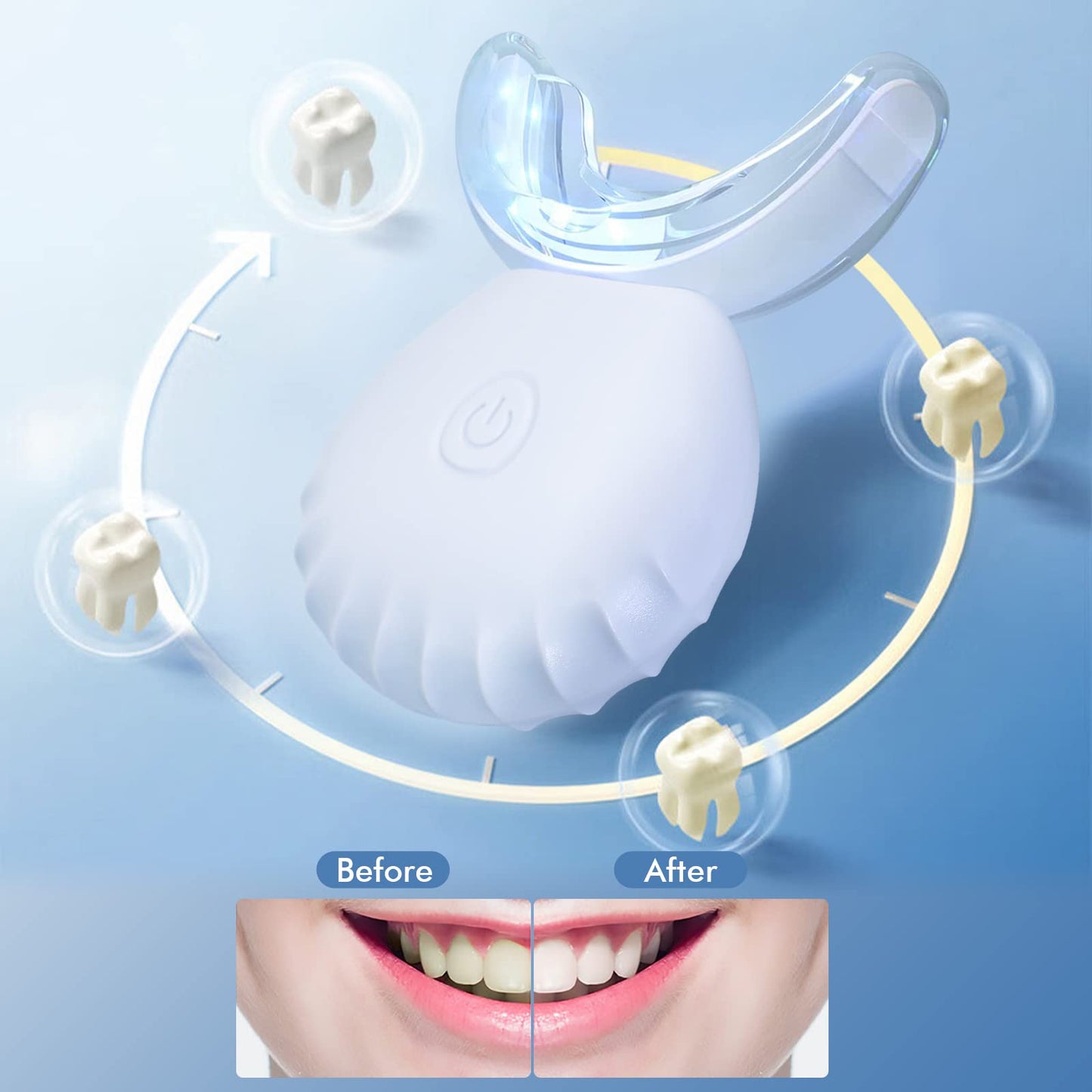 Teeth Whitening Light – USB Blue LED, 10X More Powerful, 16 LED, IPX7 Waterproof