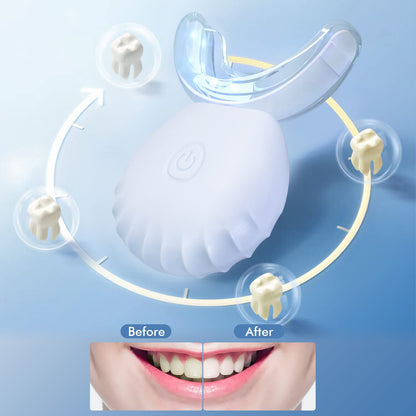 Teeth Whitening Light – USB Blue LED, 10X More Powerful, 16 LED, IPX7 Waterproof