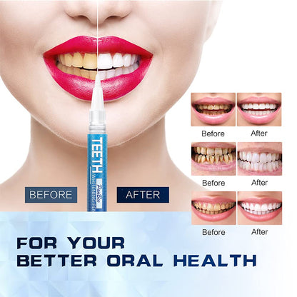Teeth Whitening Pen – 1–6 Shades in 1–2 Weeks, 70+ Uses, Gentle, Enamel-Safe, Travel-Friendly