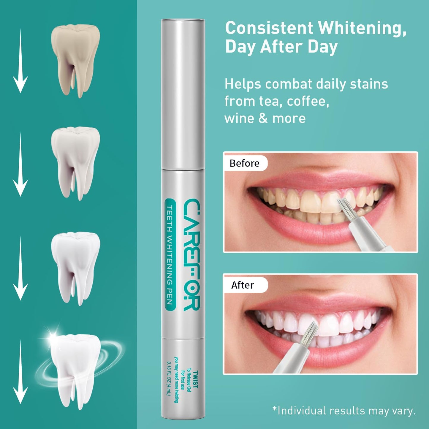 Teeth Whitening Pen 2 Pack (8ml) – Fast-Acting Gel with Brush