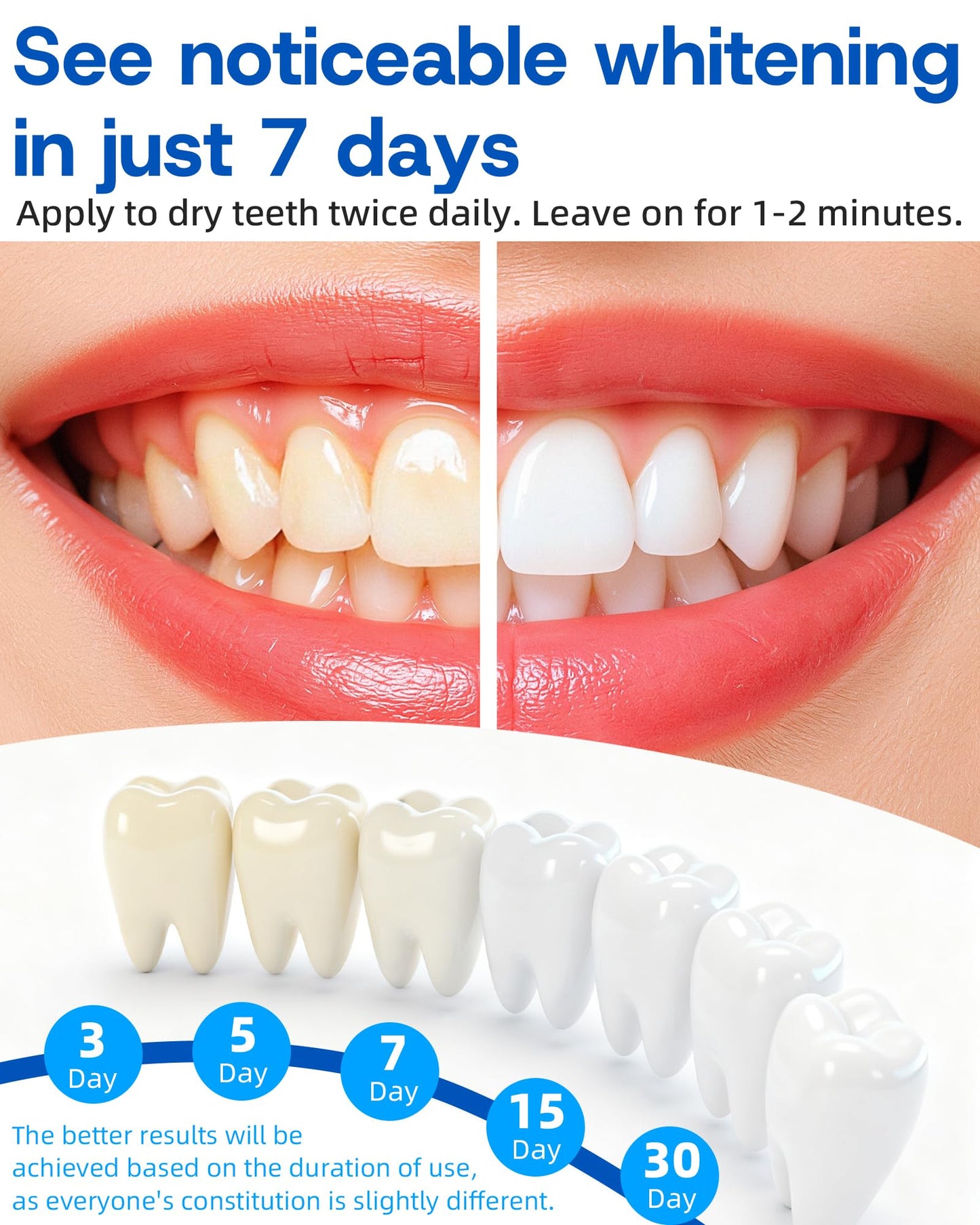 Teeth Whitening Pen 4 Pcs - 35% Carbamide Peroxide Gel | Travel-Portable