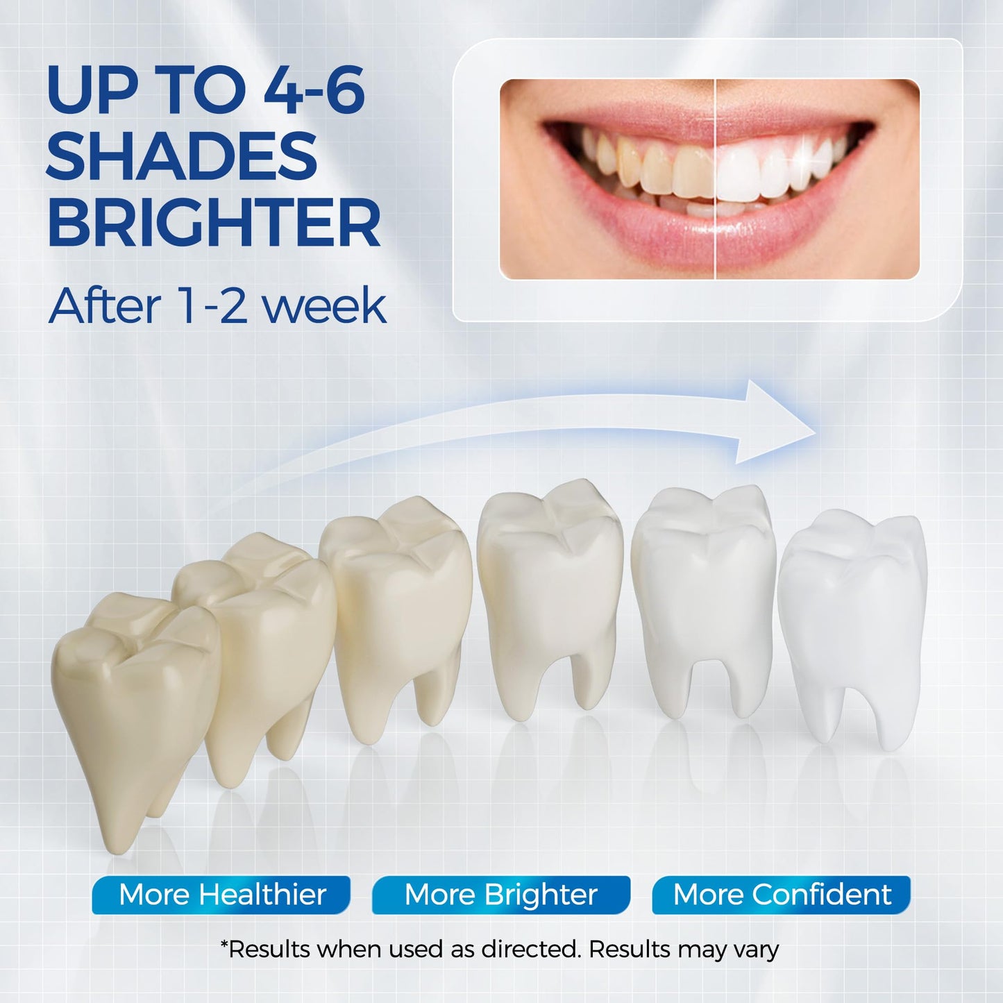 5 x Teeth Whitening Pen Gel (4+1 Desensitizing Gel) – Travel-Friendly Carbamide Peroxide Kit