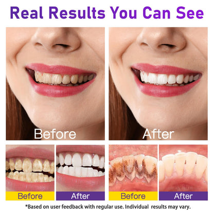 Teeth Whitening Powder – Removes Stains, No Sensitivity, Enamel-Safe Whitening