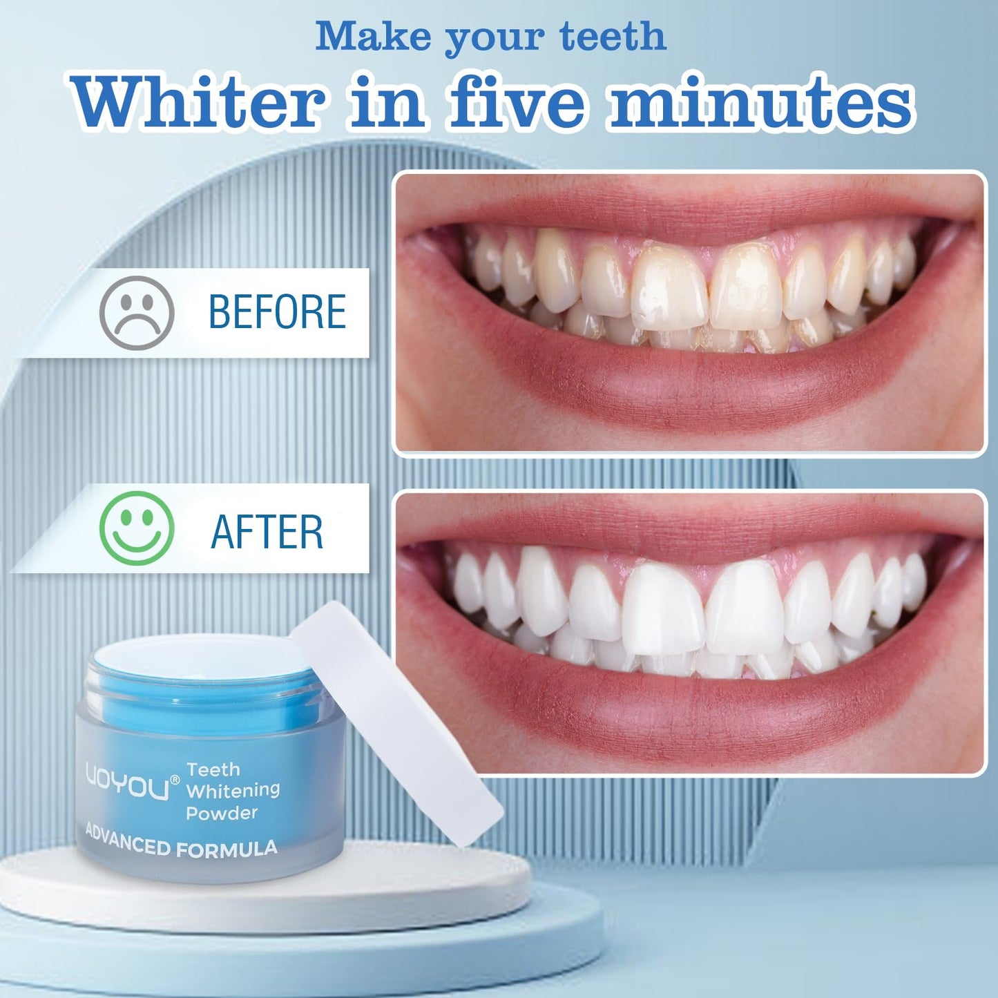 UOYOU Teeth Whitening Powder – Dentist Approved, Enamel Safe, Peroxide-Free