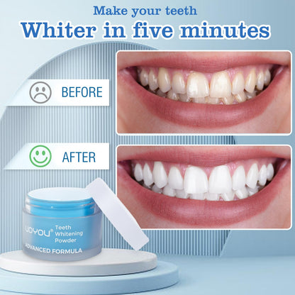 UOYOU Teeth Whitening Powder – Dentist Approved, Enamel Safe, Peroxide-Free