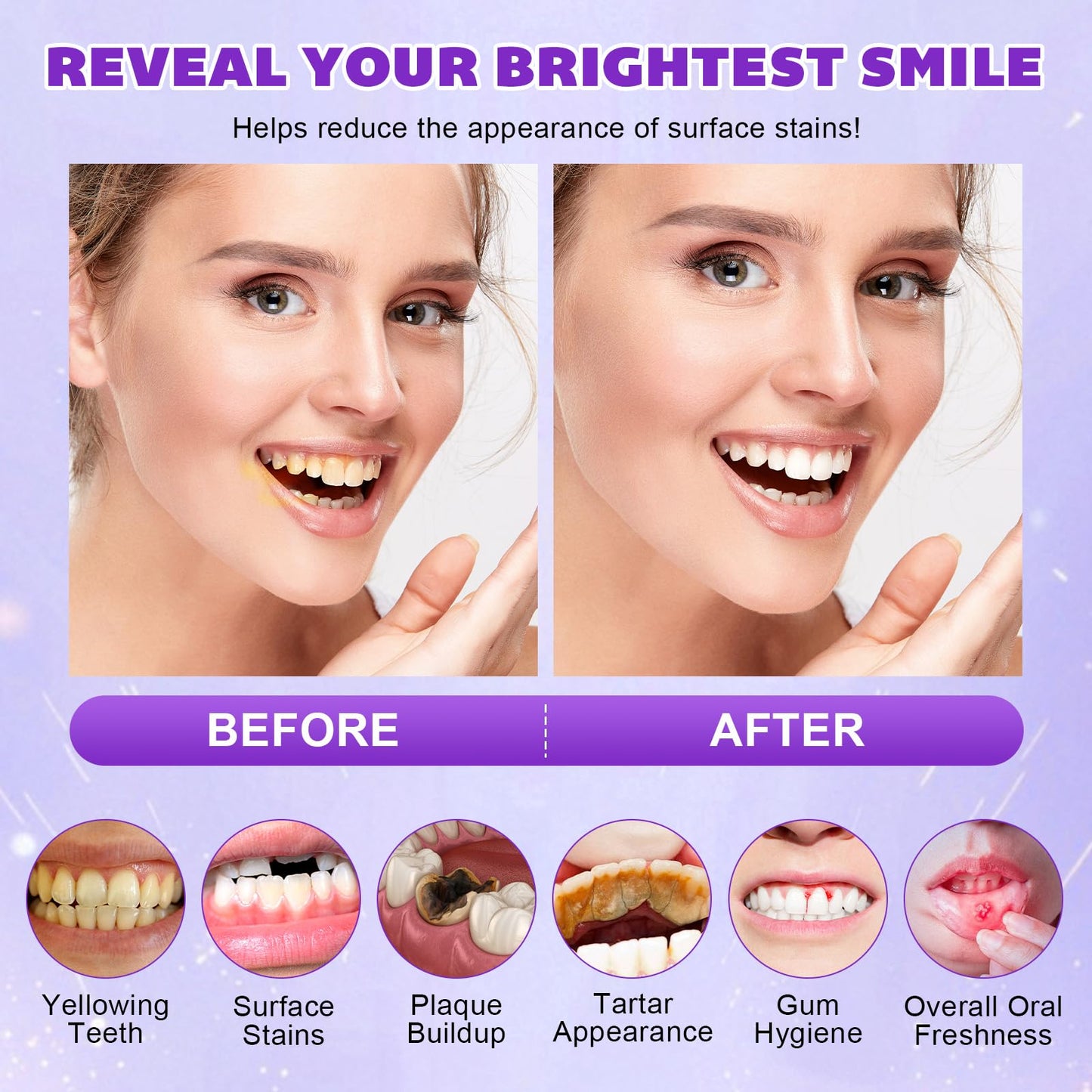 Teeth Whitening Powder with PAP+ – Peroxide-Free, Enamel Safe (35g)