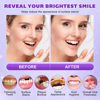 Teeth Whitening Powder with PAP+ – Peroxide-Free, Enamel Safe (35g)