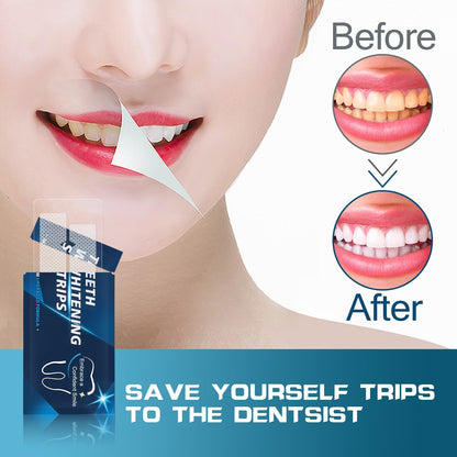 Teeth Whitening Strips - 14 Strips, Non-Slip for Sensitive Teeth | 7-Set Whitening Kit