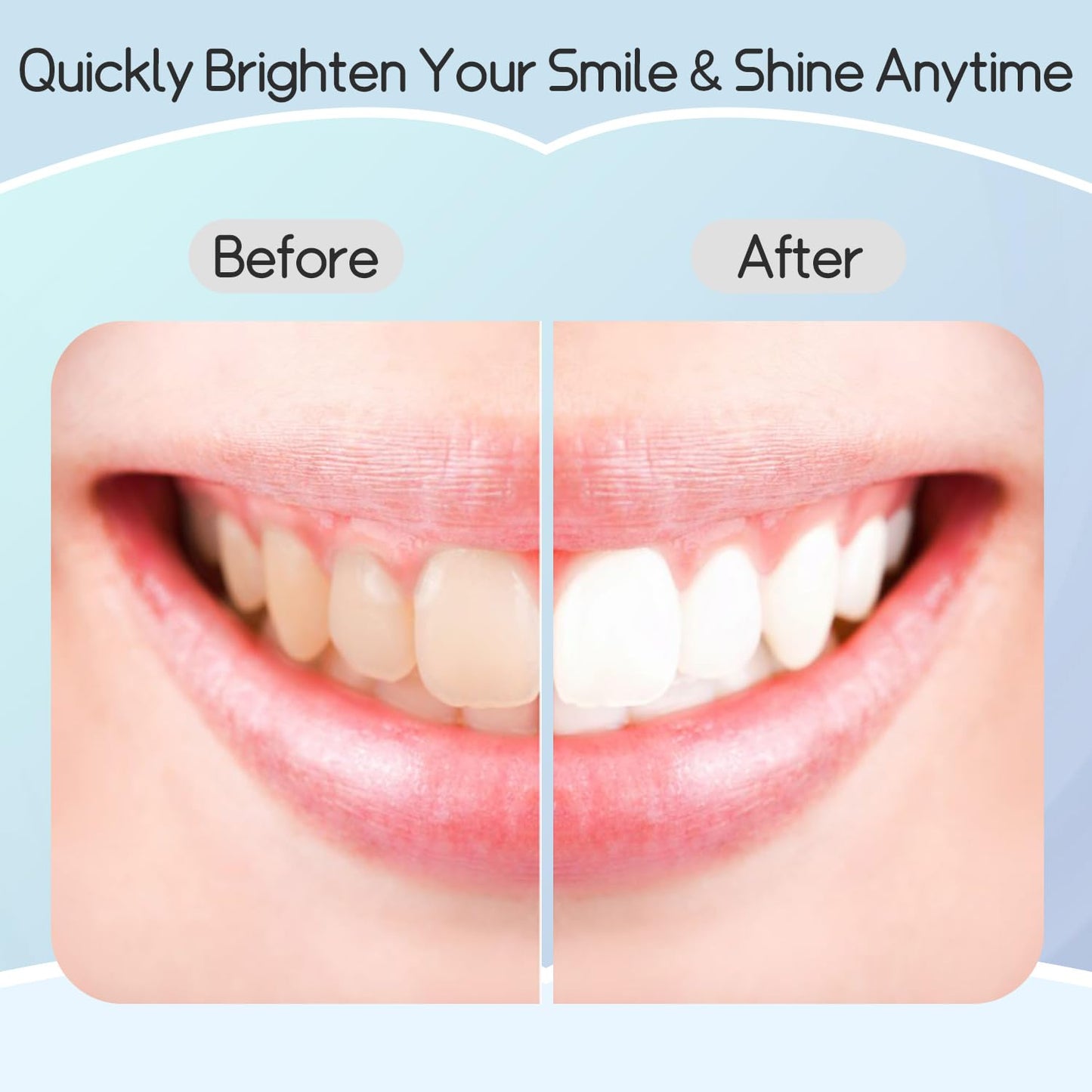 Teeth Whitening Strips – Professional Effects, Safe & Gentle, 7-Day Stain Removal