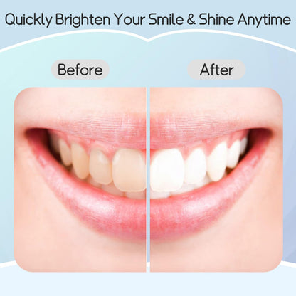 Teeth Whitening Strips – Professional Effects, Safe & Gentle, 7-Day Stain Removal