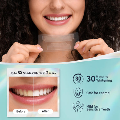 Teeth Whitening Strips Kit with Pen – Sensitive Teeth Safe (14 Strips)