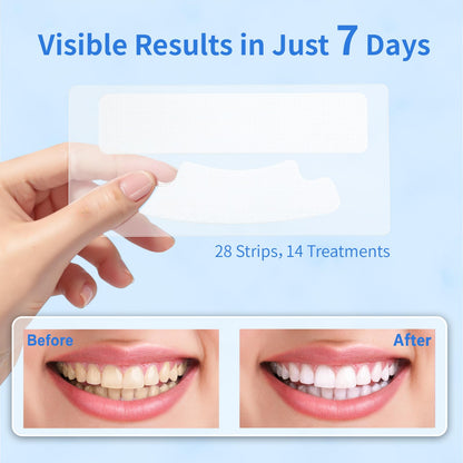 Teeth Whitening Strips with Coconut Oil Flavor – 28 Peroxide-Free Strips