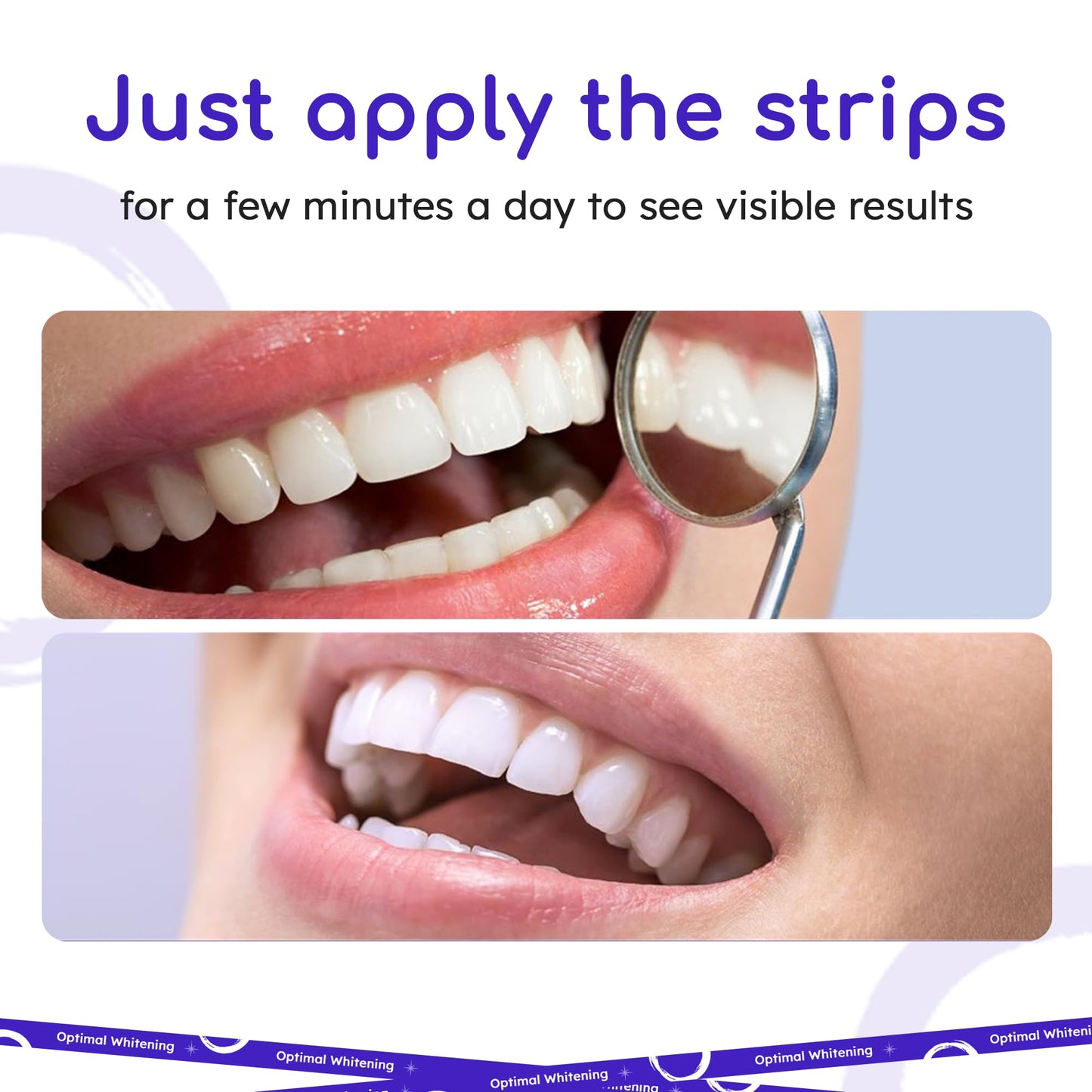Teeth Whitening Strips for Sensitive Teeth – 14-Day Full Treatment Kit | Fast-Acting