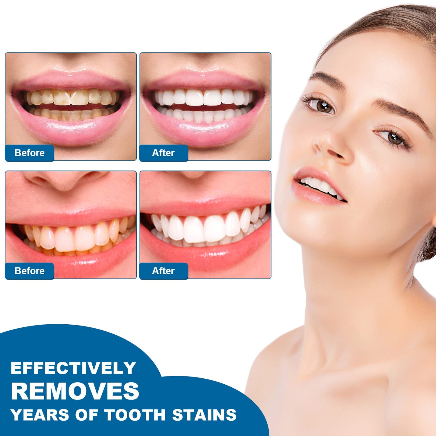 Teeth Whitening Essence Pen (3pcs) – Remove Stains, Fresh Breath, Reduce Yellowing