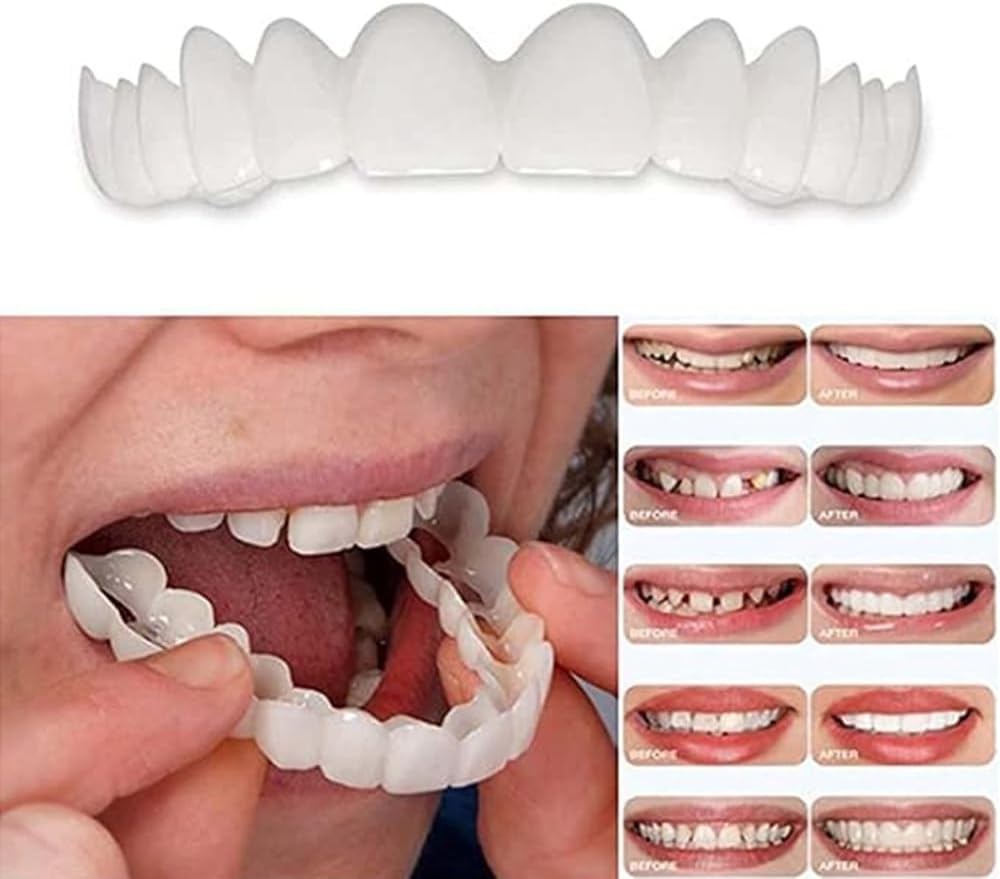 Temporary Adjustable Smile Support - 2 Pairs, Comfortable & Secure, Top & Bottom Included‌ (1)