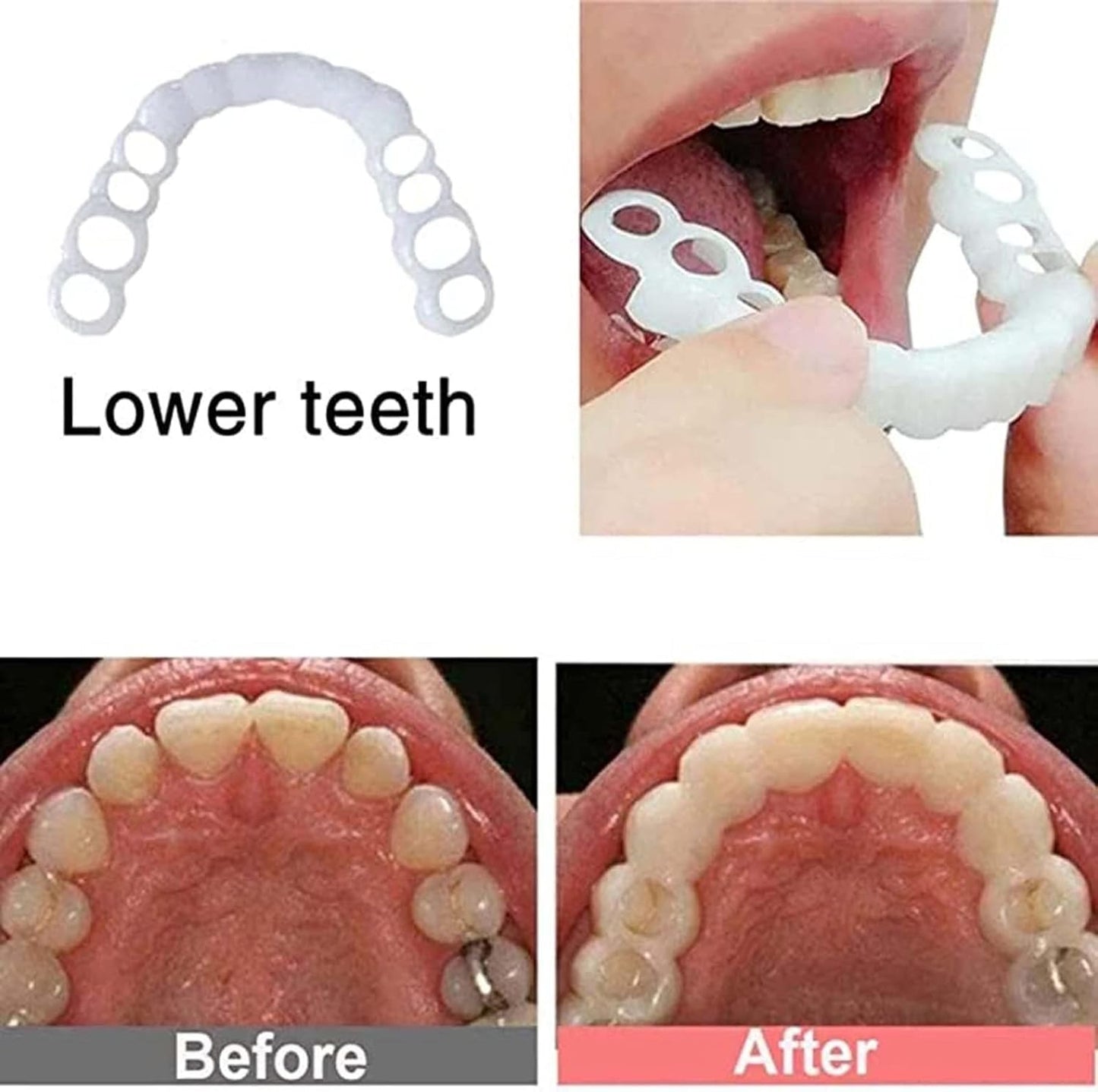 Temporary Smile Solution - 2 Pairs, Adjustable & Comfortable, Restores Confidence for All (1)