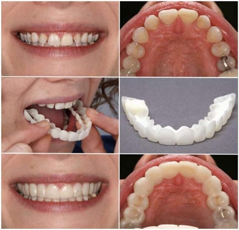Temporary Smile Solution - 2 Pairs, Adjustable & Comfortable, Restores Confidence for All (1)