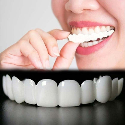 2 Pairs Temporary Smile Supports - Top & Bottom, Natural White, Comfortable