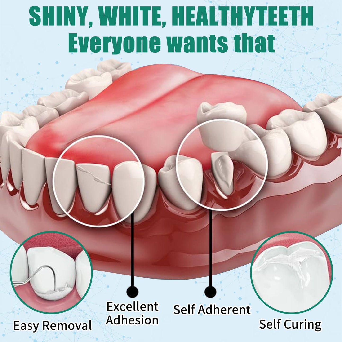 Temporary Tooth Repair Kit – Zinc Oxide Eugenol Cement for Crowns & Bridges | Perfect Smile (6)