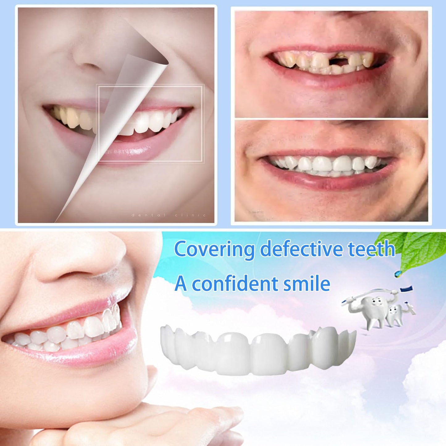 Temporary Veneer Kit for Men & Women - Adjustable, Natural & Comfortable (2/4 Piece Set)