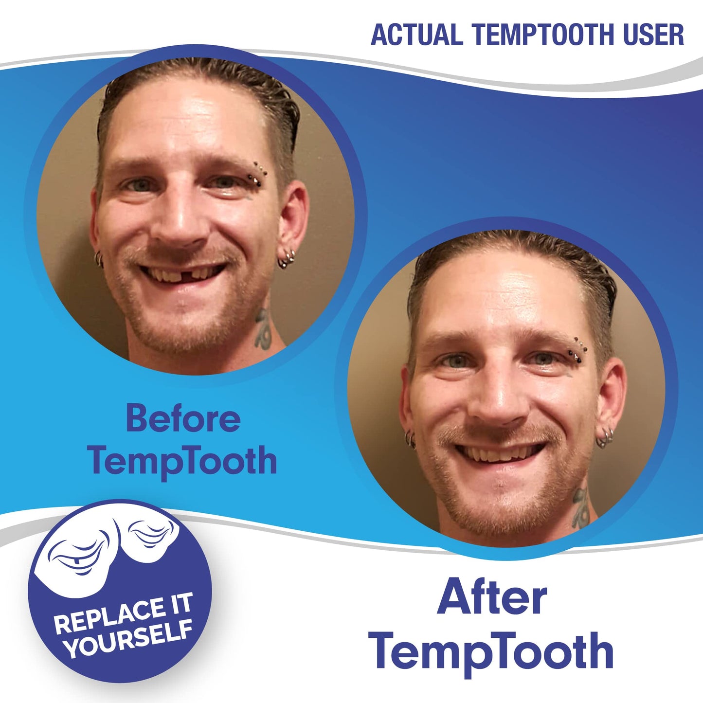 Temptooth: Trusted Patented Temporary Tooth Replacement Kit