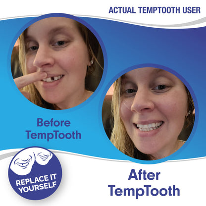 Temptooth: Trusted Patented Temporary Tooth Replacement Kit