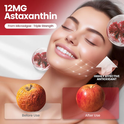 Astaxanthin 12mg – 240 Softgels | Haematococcus Pluvialis 10-in-1 Antioxidant for Eyes, Joints & Skin