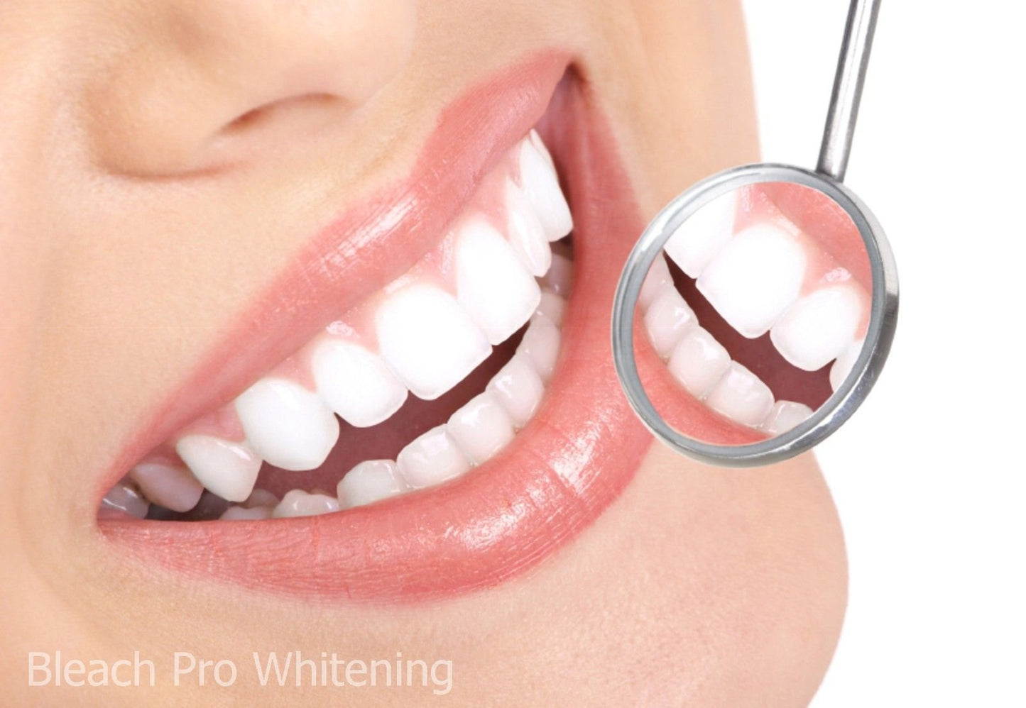 Teeth Whitening Gel Syringe Dispensers – 22% Carbamide Peroxide, 10 x 3ml Syringes
