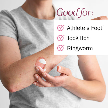 TenderGentle Clotrimazole Antifungal Cream for Skin – 4 oz (Jock Itch & Athlete’s Foot)