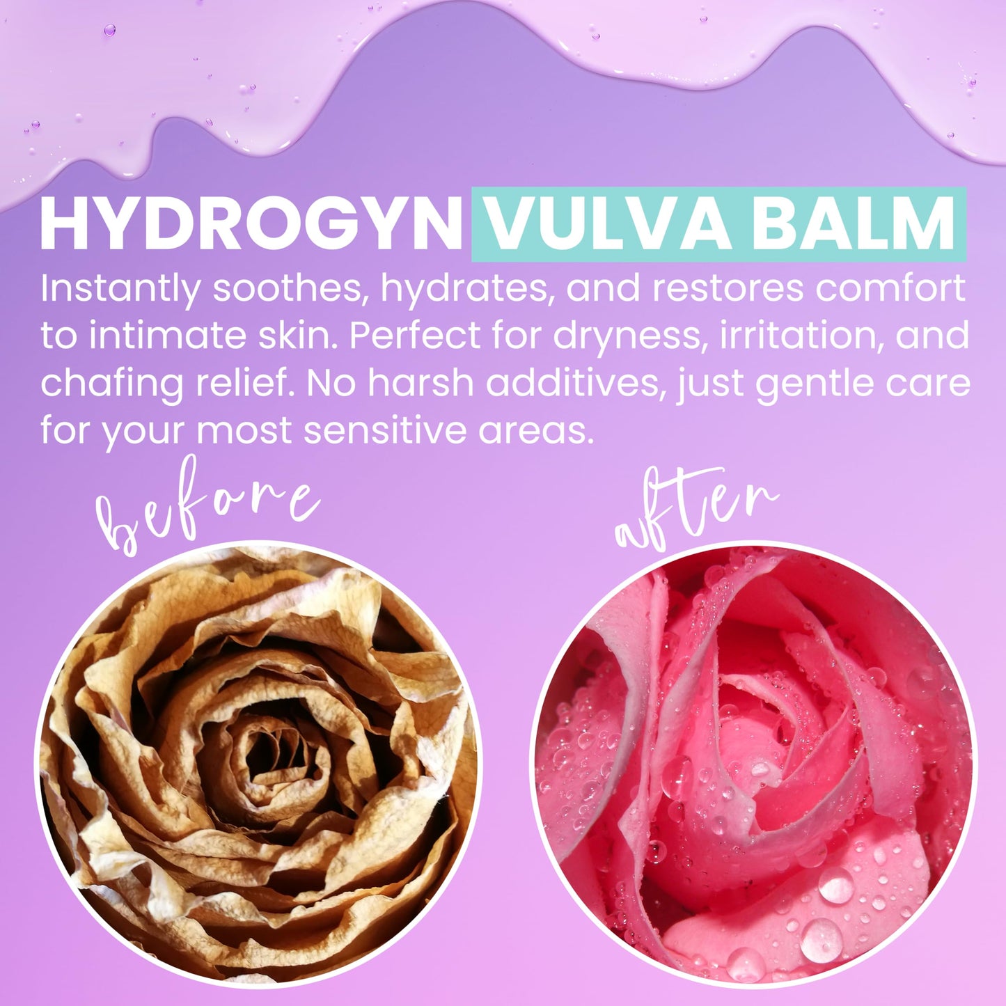 Terramed HydroGyn Vulva Balm – Hormone-Free Vaginal Moisturizer, Menopause Support, pH-Balanced