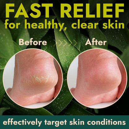 Terramed Just Think Comfort Foot Balm Stick for Dry Cracked Feet | Intensive Moisturizing | No Mess Applicator | 2 Pack