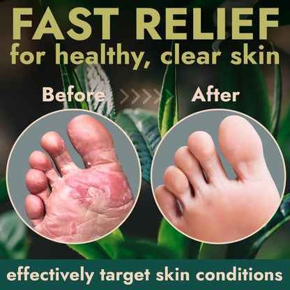 Terramed Just Think Comfort Foot Spray with Tea Tree Oil | Fast-Absorbing Antifungal Relief 120ml