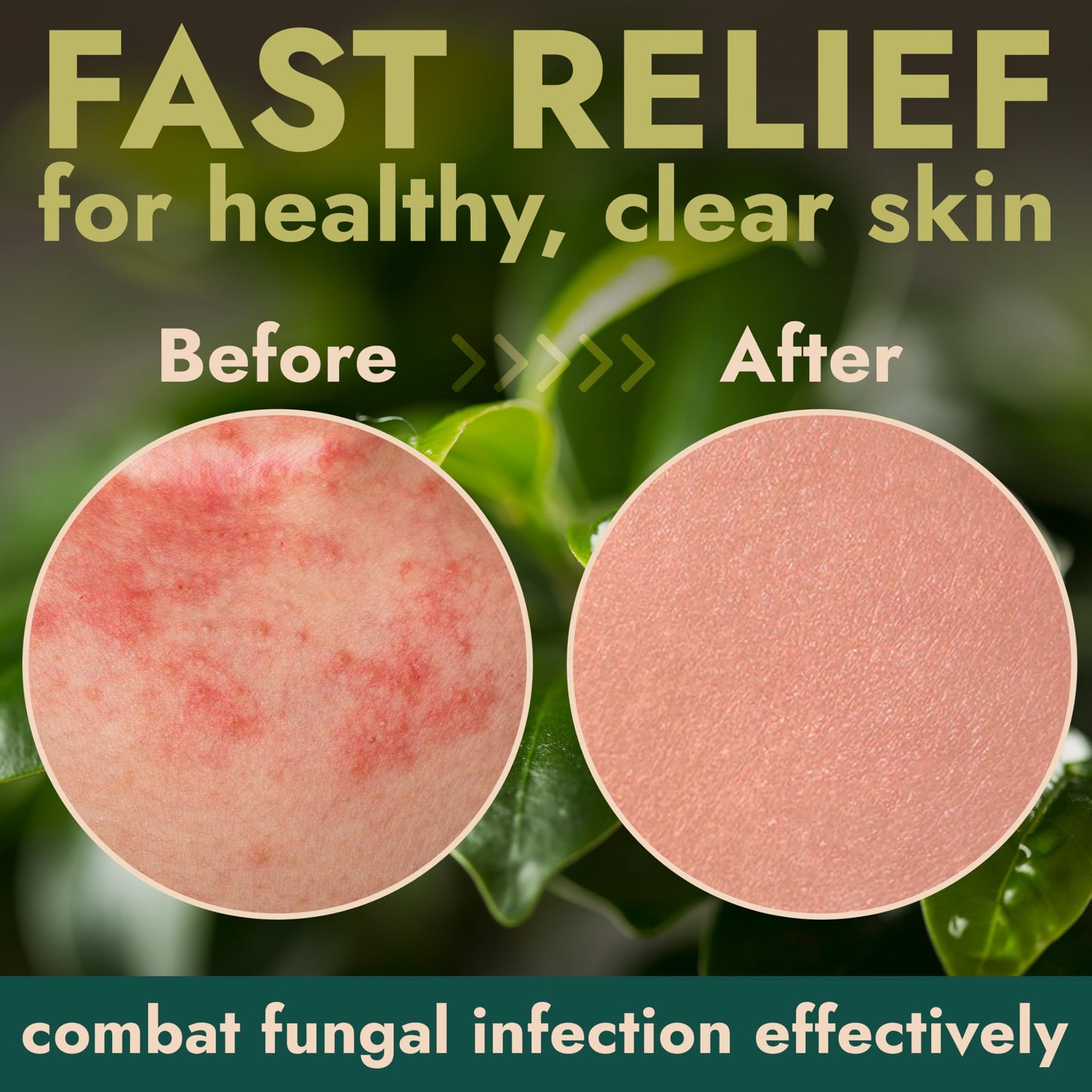 Terramed Just Think Comfort Tea Tree Body Spray | Fast-Absorbing Antifungal (120ml)