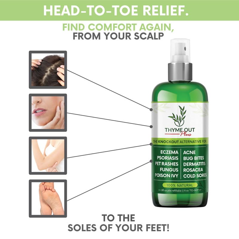Thyme Out Plus All-Natural Skin Soothing Spray — Eczema, Rosacea, Psoriasis & More | Thyme Out
