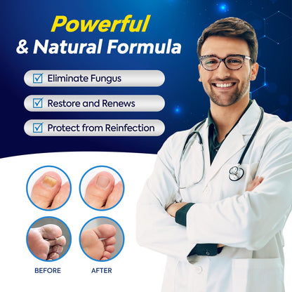 Tobcharm Toenail Fungus Treatment - 25% Undecylenic Acid, Extra Strength (2pcs)