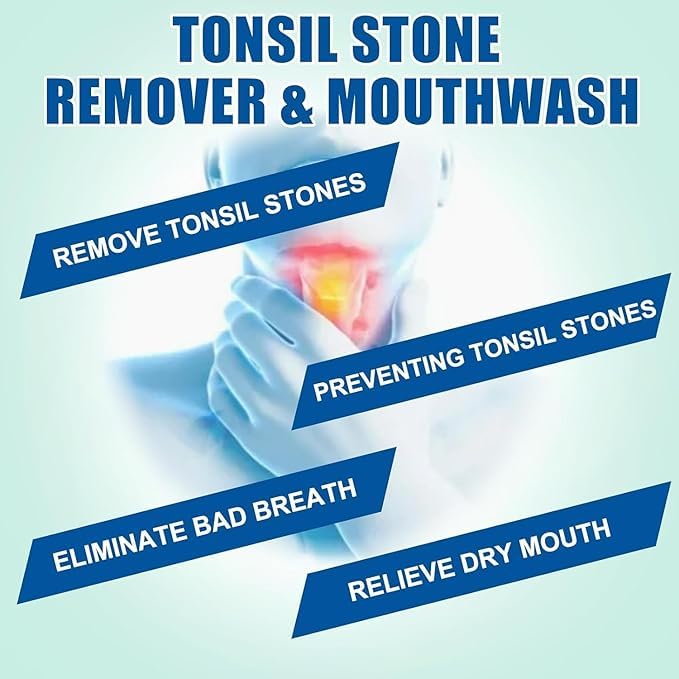 Tonsil Rinse Mouthwash – Stone Remover, Alcohol-Free Mint 10 FL OZ