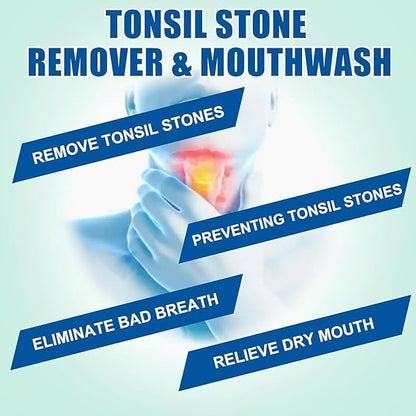 Tonsil Rinse Mouthwash – Stone Remover, Alcohol-Free Mint 10 FL OZ