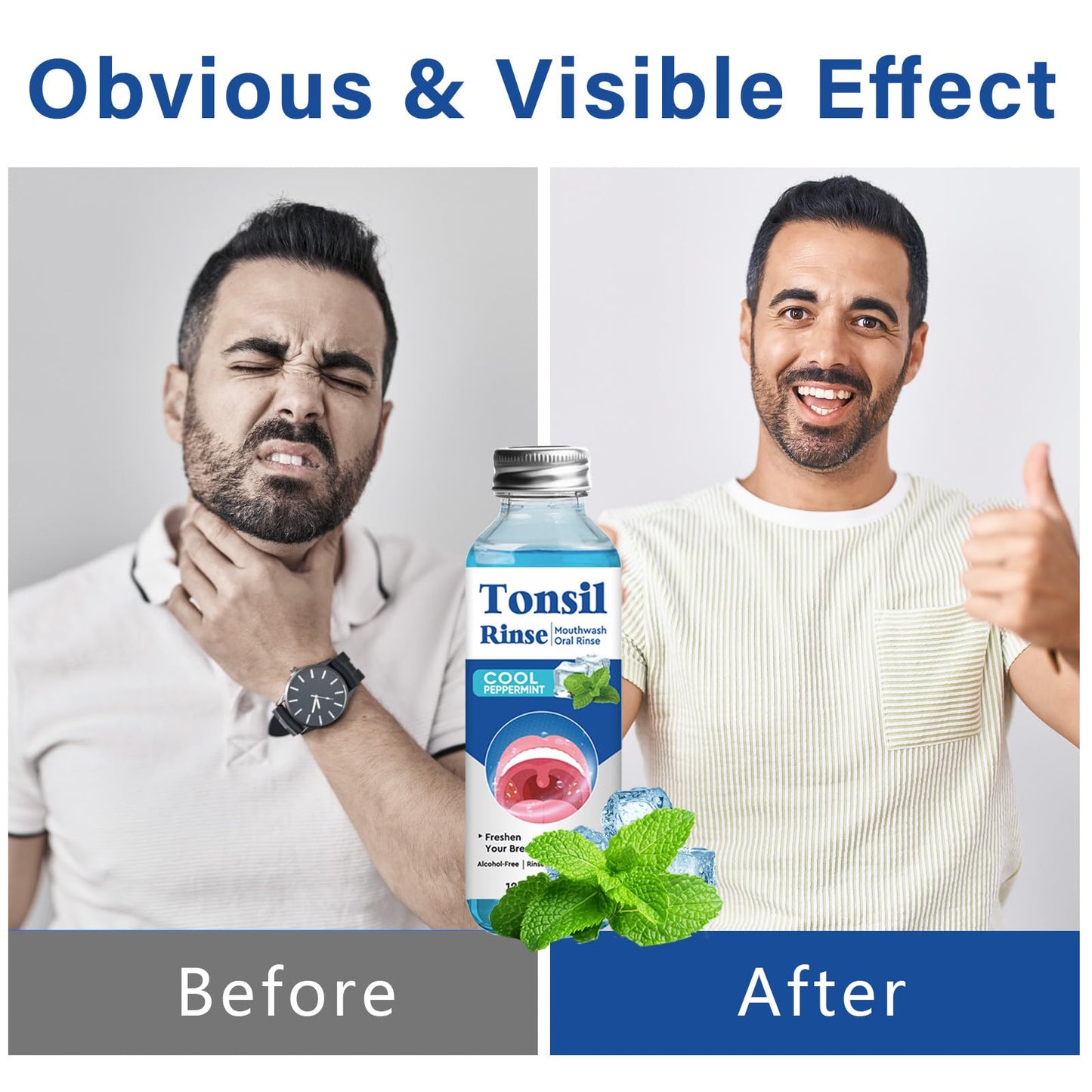 Tonsil Stone Remover Mouthwash – Soothe Tonsils, Fresh Breath