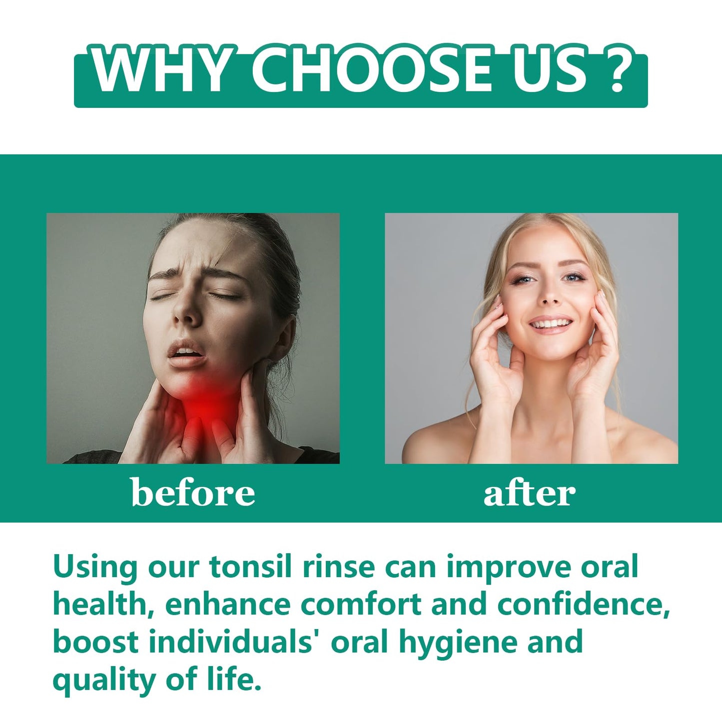 Tonsil Stone Remover with Alcohol-Free Oral Rinse – 300ml (10.14 fl oz) | Soothe Tonsils & Freshen Breath