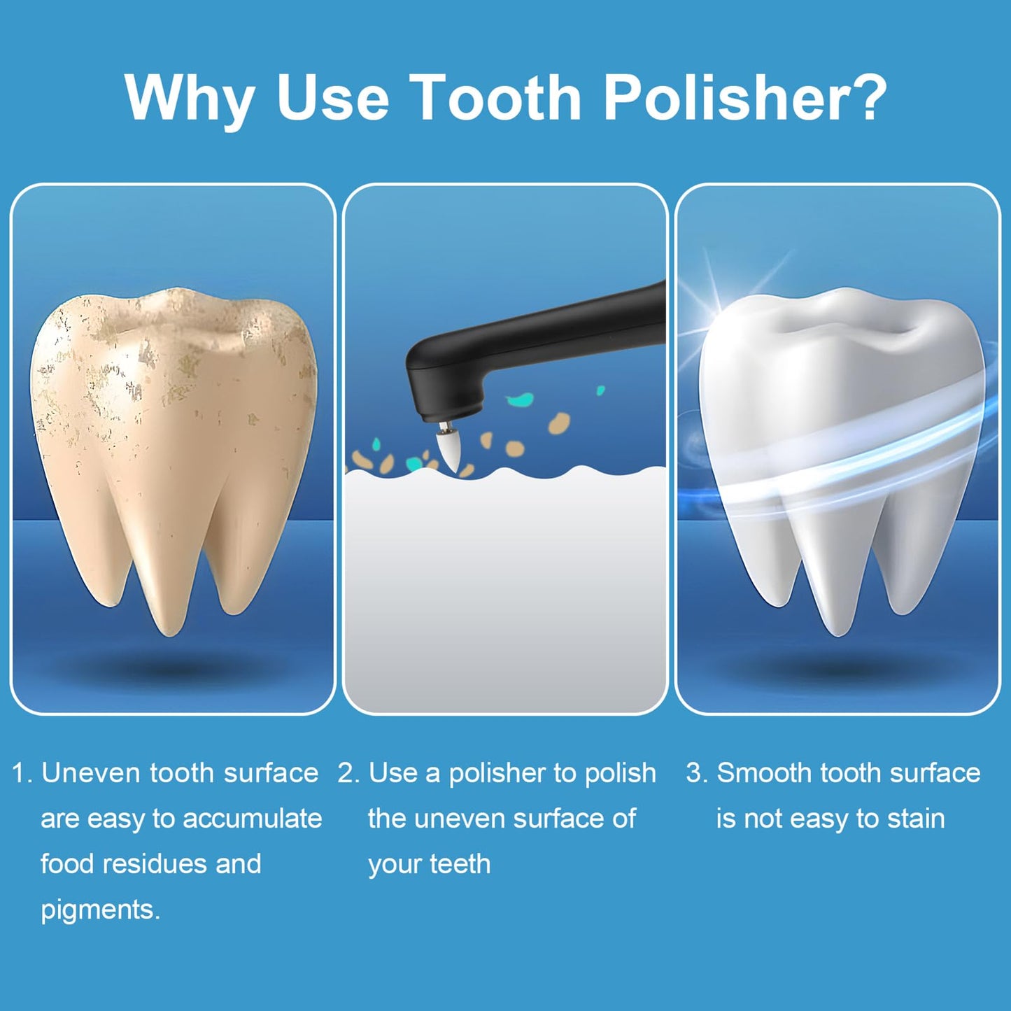 SIQUER Tooth Polisher Plaque Remover for Teeth Whitening | LED, 5 Speeds, 5 Heads